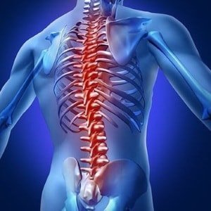 malattie-spinale-colonna