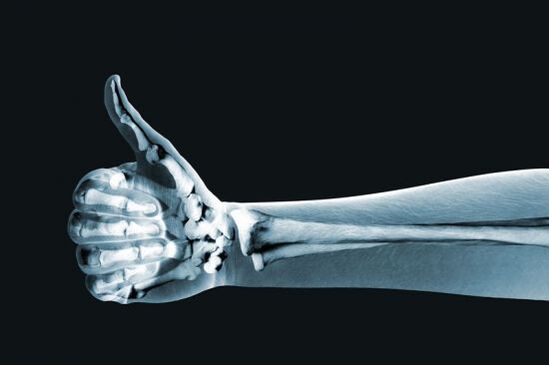 I raggi X possono essere utili per diagnosticare il dolore alle articolazioni delle dita